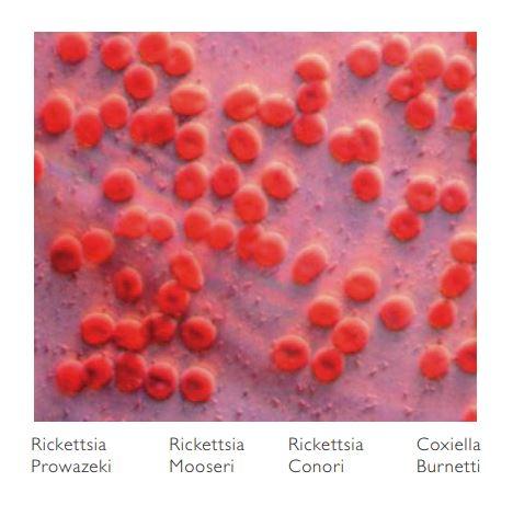 Bacteria and metabolism analysis for microbiota health status detection